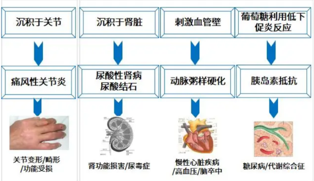 "周末谈健康：痛风的要点你需要知道？"