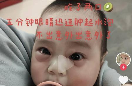 真实案例：七个月宝宝断崖式衰老？真的要谨防‘4岁前不能吃猕猴桃’？”