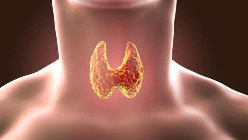 谨慎的声音沙哑、吞咽困难？这是甲状腺囊肿的早期预警信号，快来看看是否需要进行检查!