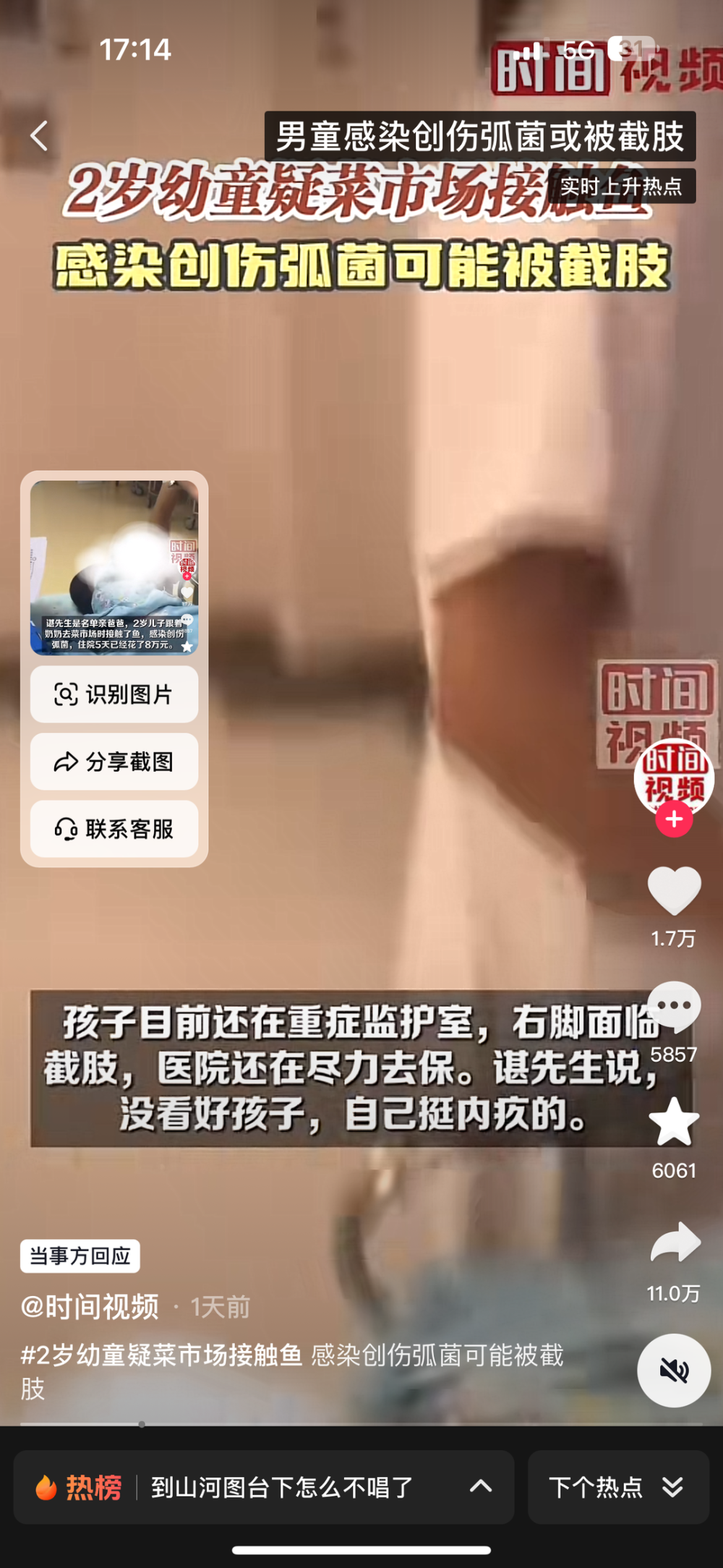 "警惕海水中的创伤弧菌：被刺后可能致命，谨慎对待海洋食物!"