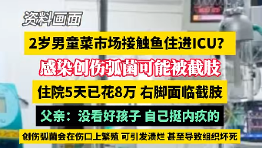 警惕！2岁男童住进ICU面临截肢！只因去了趟菜场？