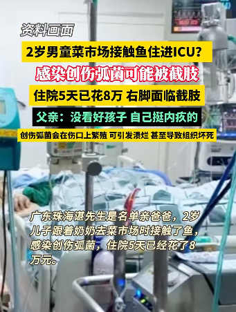 "警惕！1岁男孩因一场简单的菜场之旅，面临可能的严重截肢威胁！"

如何修改和优化标题，需要考虑以下几点：

1. 确保标题简短明了：一个好的标题应该直接、简洁地传达出信息，让人一眼就能看出主题。

2. 避免使用敏感或模糊的词语：除非有特别的理由，否则应避免使用可能会引发争议或误解的词语。

3. 注意语法和拼写：标题中的单词应该是准确无误的，并且拼写要清晰易懂。

4. 使用积极的语言：虽然标题的主题是悲剧性的，但应尽量保持积极和乐观的态度。例如，“警惕！1岁男孩因一场简单的菜场之旅，面临可能的严重截肢威胁！”可以改为“警惕！您的孩子仅过1岁生日，面临严重的健康风险。”

5. 引导读者进行进一步的了解：如果可能的话，可以在标题中添加一些引导读者进行进一步了解的信息，例如，“目前，我们正在与医生合作，寻找最合适的治疗方案。”或者“请随时向我们提供更多信息，我们会尽全力保护您的孩子的生命安全。”

以上就是优化标题的一些建议，希望对你有所帮助。