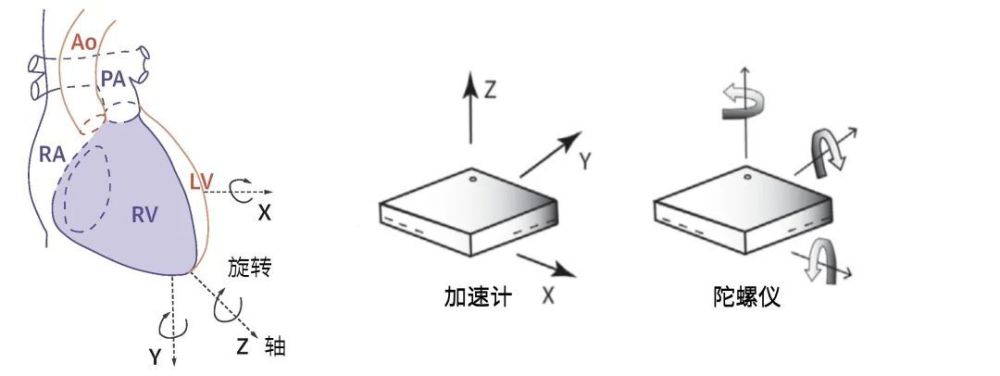 "3分钟了解心脏病风险：手机放胸口测试准确性高达89%"