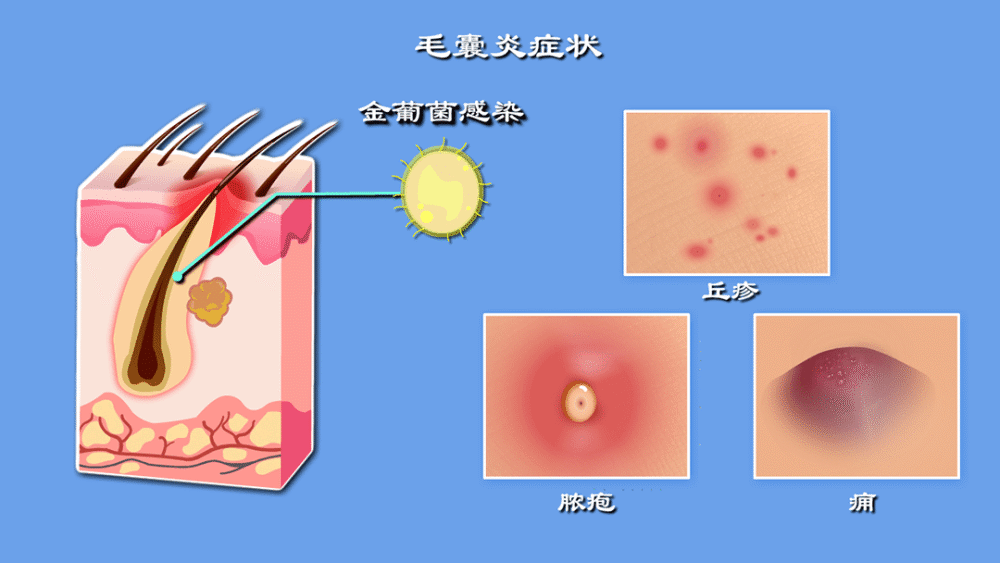 "头皮痒、痛与脱发：一网打尽原因与防范策略"