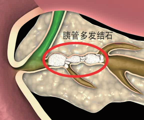 "隔山打牛：挑战消化道的全球难题，揭开科学之谜——走近《走读科学》"