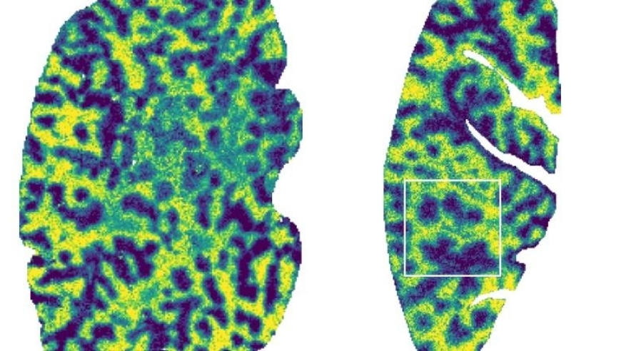 解析小鼠肝脏的精细时空结构，中国的科学家绘制出科学蓝图