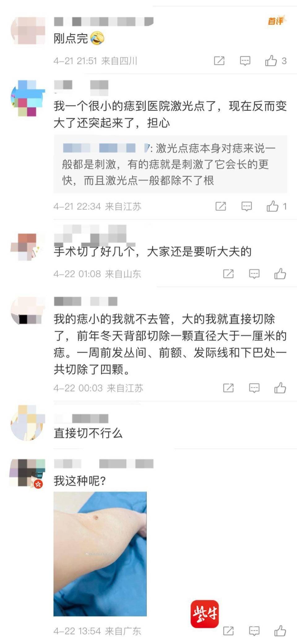 "网红说法：不建议轻易点痣"