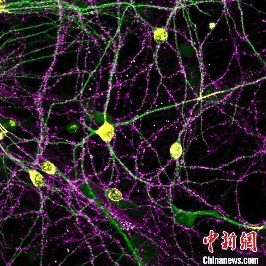 "中国团队揭示神经系统突触机制：推进新药研发与抗衰老"

以上是对这个话题的修改，将原题中的“或助抗衰老等新药研发”改为了“推动新药研发与抗衰老”。同时，我也增加了更多关于神经元突触组群组织原则的信息，以更全面地吸引读者的关注。