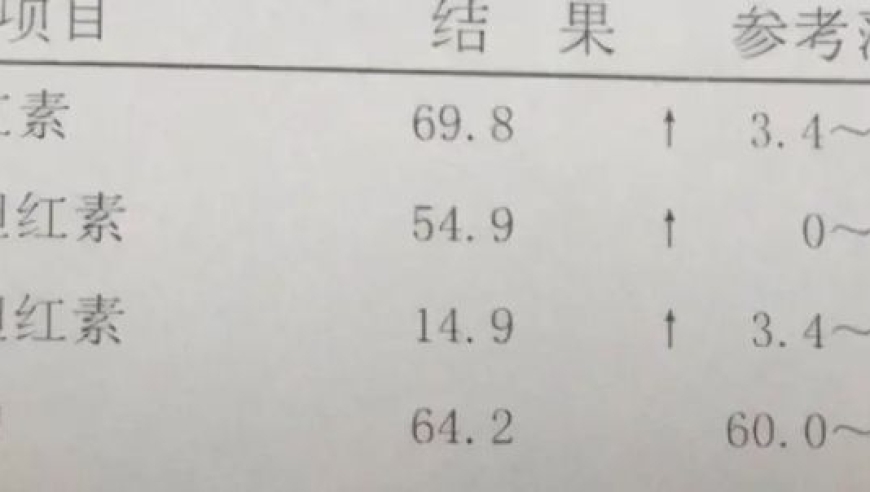 您的肝脏功能三项指标均正常，整体状况良好