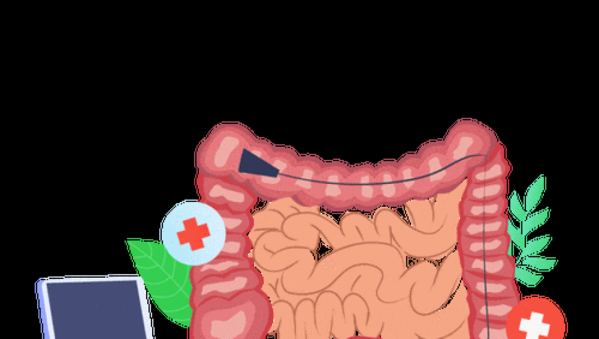 互联网专家：带你了解肠镜检查的全貌与常见问题，早发现早治疗