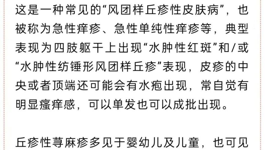 警惕高热不退的高温症状！长沙女子双下肢起红斑、风团、水疱，急需就医