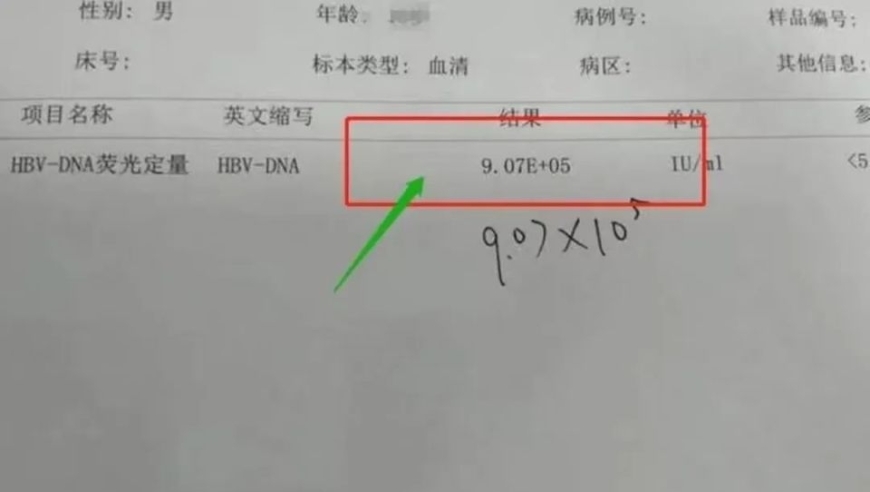 控制好这 4个指标，肝硬化绕道走，乙肝朋友如何通过这些指标有效控制？