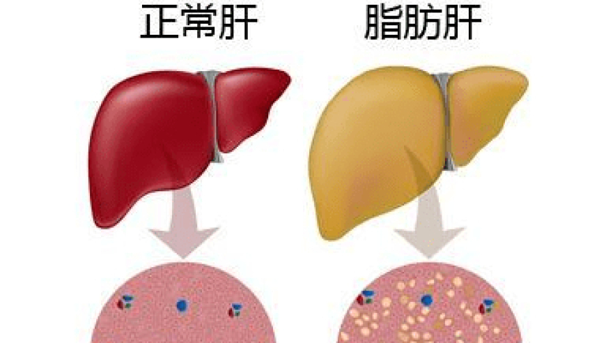 深入了解养肝与生命之间的密不可分关系：一项科学实证的研究发现