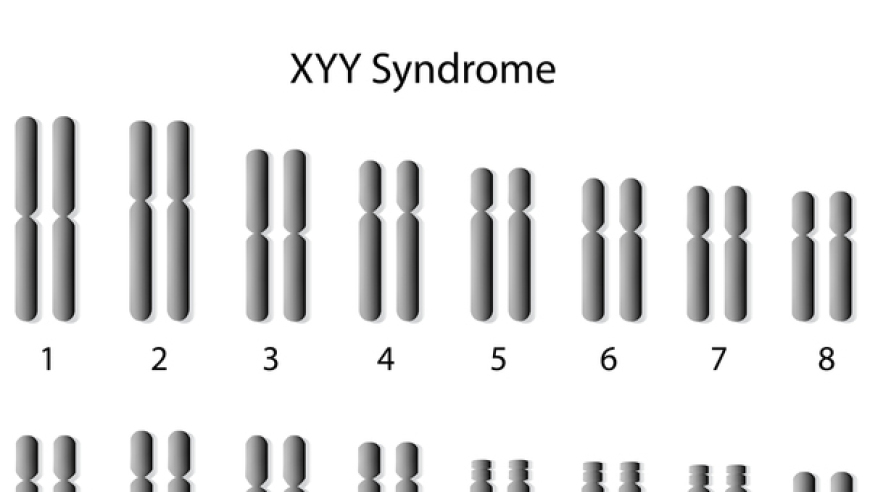 究竟为何，XYY患者多被视作暴力狂？