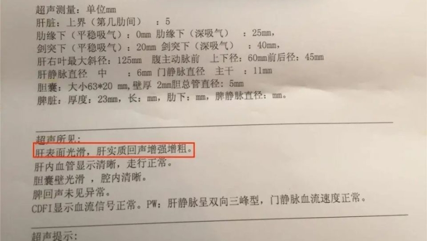 在B超检查中发现这些迹象，千万不能忽视！肝脏健康预警信号

优化后的 

实时警示！肝脏B超有这4种异常，千万要注意！健康生活从了解肝部状况开始