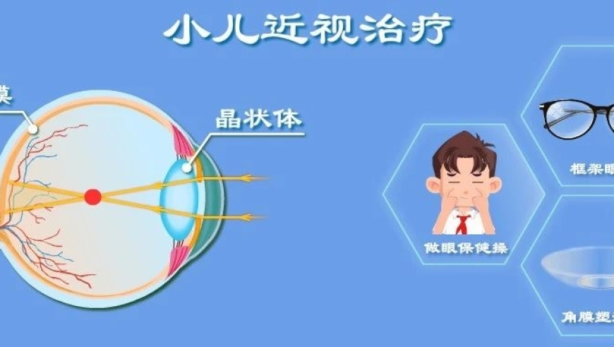 戴一晚上的眼镜，孩子近视也能轻松治！

这个神奇的眼镜可以让你一夜之间看清楚世界