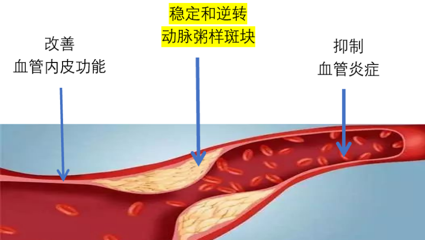 全面解读：他汀类药物的使用时间与停药限制，你的疑问医生都在解答！