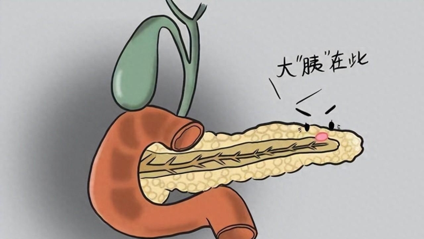 及时了解胰腺癌的症状与防病知识，早发现早治疗至关重要