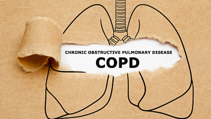 我国研究揭示：脂肪分解对慢性阻塞性肺疾病有重要影响