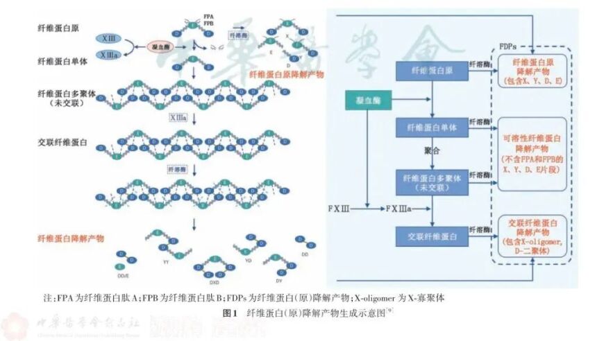 如何识别并排除肺栓塞？牢记10项排查要点