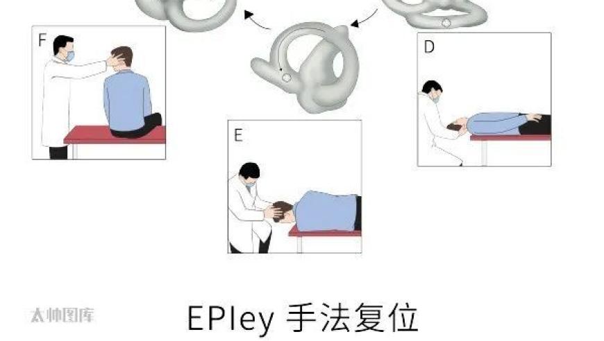 全面解析：耳石症的定义、原因与解决方法