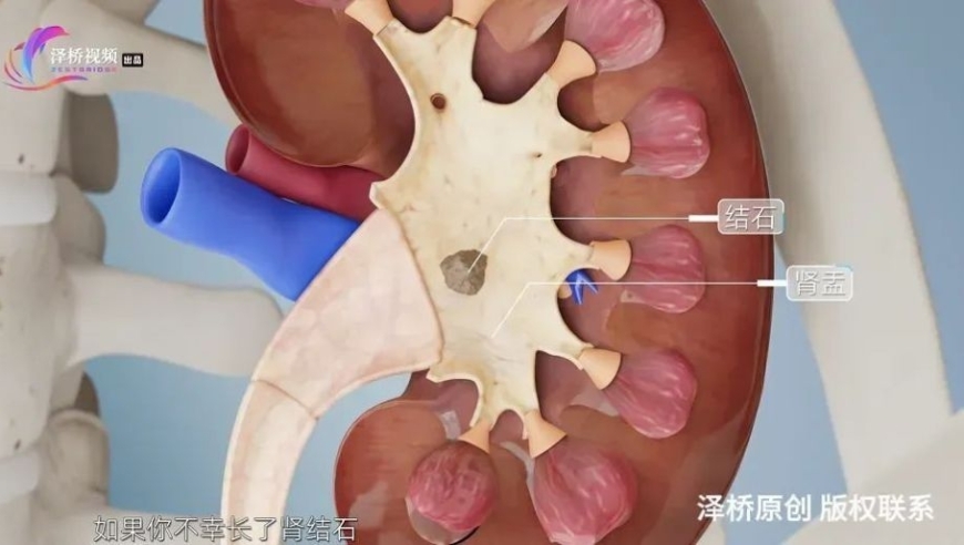 切勿忽视：尿液异常可能是癌症的警示信号