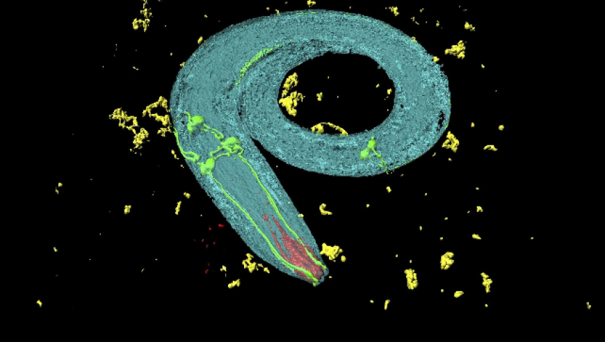 2024年诺贝尔生理学或医学奖公布！杆线虫成为亮点，这1毫米‘透明’小生物备受推崇