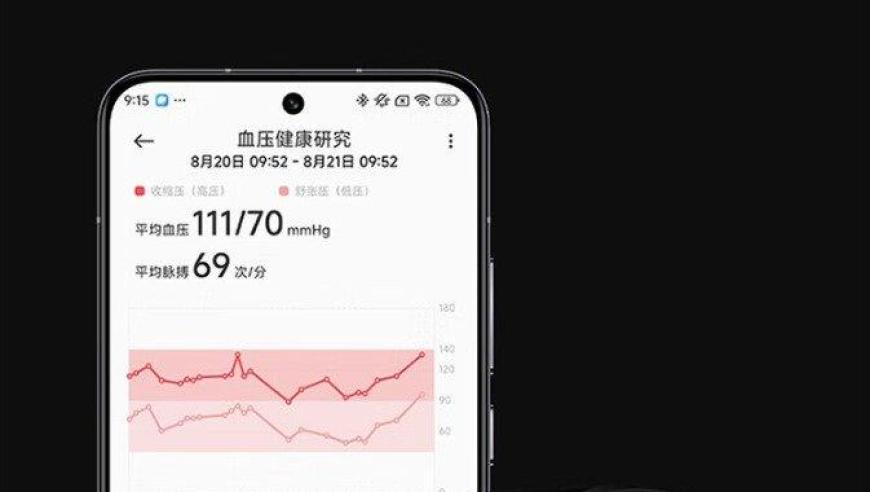 小米 Watch H1 E 高精度全天血压计在线销售，便捷查看健康数据
