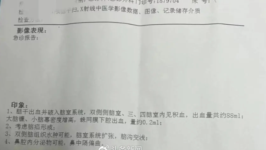 网红下播后ICU治疗：这个病真的很危险，务必警惕