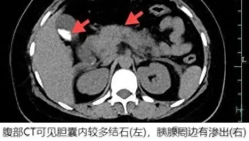 奇迹发生：25岁女子夜抢救成功，一小时仅用180秒做出美味佳肴