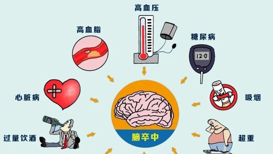 掌握90%的卒中风险因素，提高生活质量：日常生活中的关键防护措施