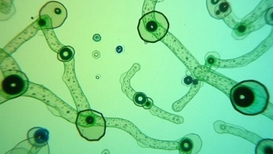 科学家揭示:肠菌失衡影响大脑昼夜节律调控中心并可能导致社交行为障碍—全新抗压益生菌研究进展