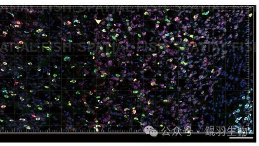 pi-FISH：全面解析 mRNA、lncRNA、miRNA等各种类型的基因检测，只需选择合适的π—FISH技术