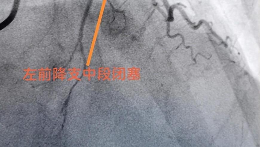 守护健康——网上的医疗知识大全，不容错过的防治指南