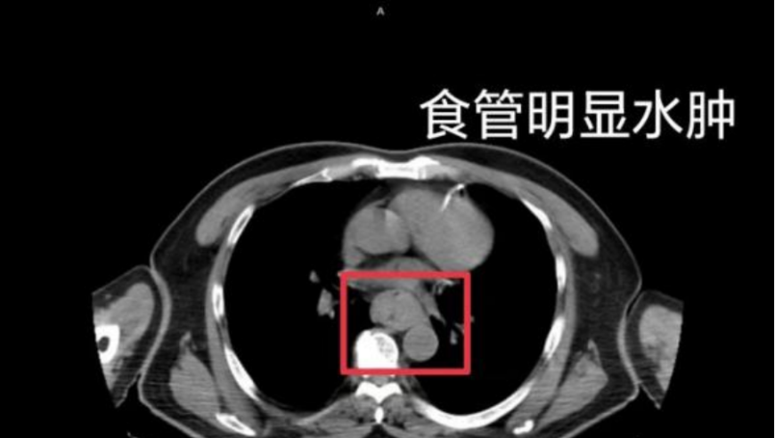 趁热食用：长期食用可能致癌的