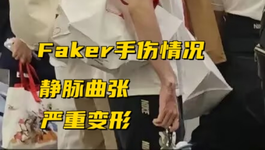 Faker的伤病情况再次引起关注：脚踝断裂，手腕严重变形，网友：需要退役吗？