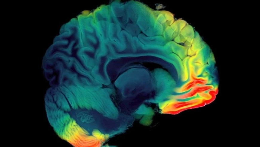 科学家揭示：新型Aβ PET技术优于传统生物标记物，提供更精确的Aβ沉积检测