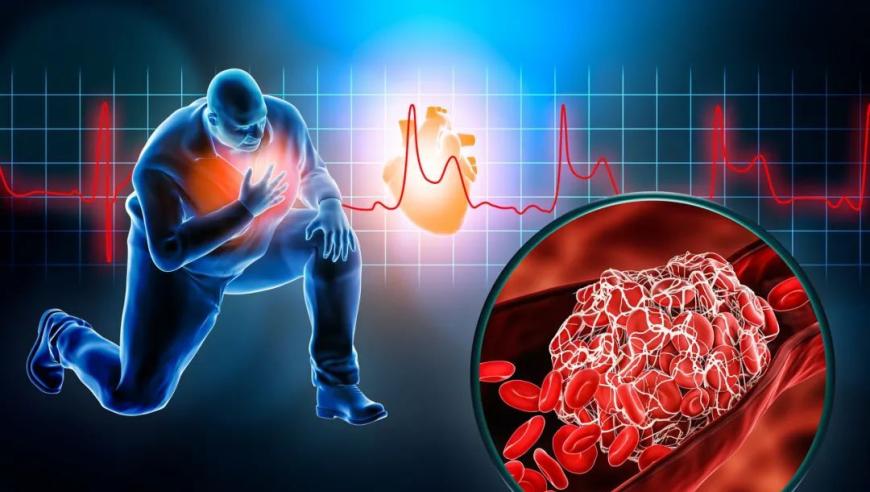 危急时刻：了解心梗的六大预警信号，关键时刻可能救你一命！