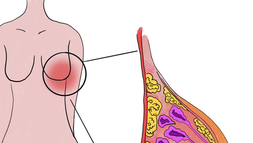 最佳选择：不是私处，这是其他部位也应避免涂抹身体乳的部位