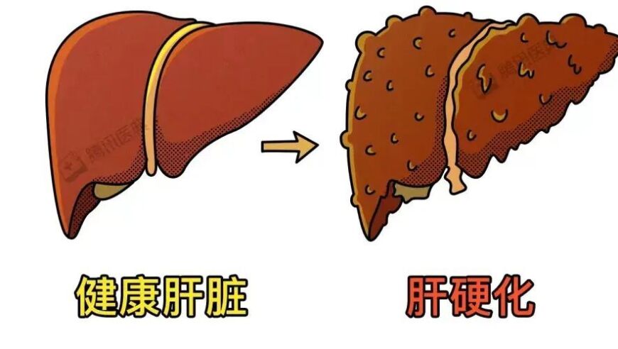 五个预示疾病迹象的异味：身体发出的信号可能就是病症的预警