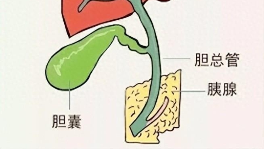 胆囊炎的四大诱因：右上腹疼痛、恶心、呕吐是关键！