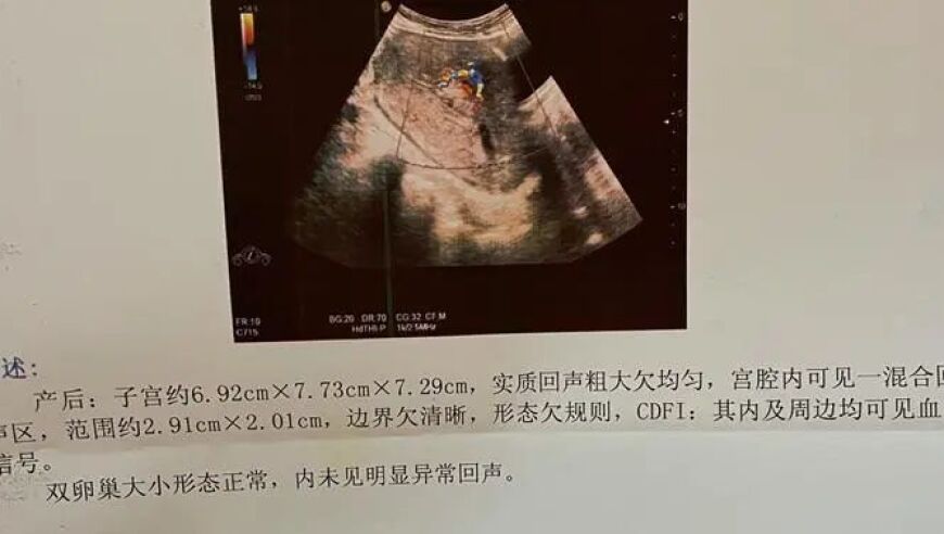 产后13天，尿液中的血液液体流出：如何处理和应对这个问题？