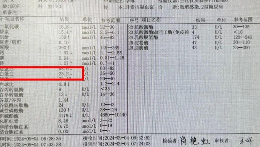 了解更多关于肾病综合征的信息：尿蛋白调整的相关指南