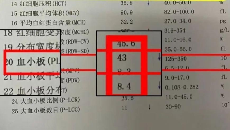 请注意：这4个指标是乙肝患者的警示信号，千万不能忽视！