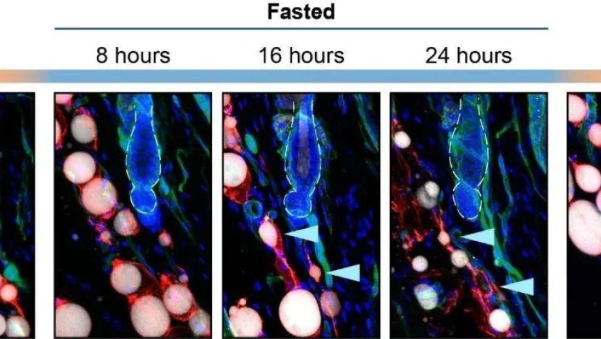 西湖大学最新研究成果：轻断食或抑制毛发生长，解析其可能影响因素及应用前景