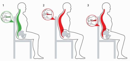 十个理由，让我们一起关注：为何许多人在工作中饱受颈椎腰椎疼痛之苦？”