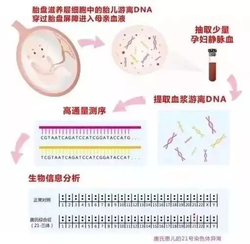 让孕妈妈轻松应对：唐筛、无创DNA、羊水穿刺三大筛查方法解析