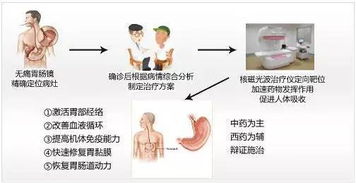 【美国胃肠病学会联合微创手术30分钟治愈静脉曲张，背后是大智慧!】：揭开健康秘密!