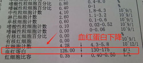 【血常规三个异常提示：警惕肝硬化脾大的预警信号！】