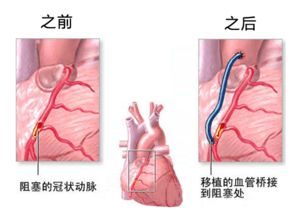 理解脑萎缩：原因、日常措施与防护
防止脑萎缩：八项日常要点，科学的脑健康守护之道